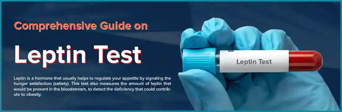 Comprehensive Guide on Leptin Test